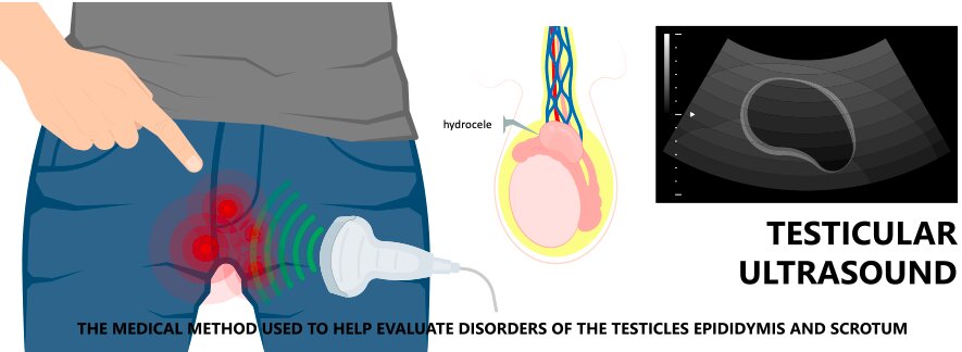 RBENIGN ENLARGEMENT OF THE PROSTATE Mumbai